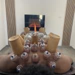 Séance cupping chez K-Therapie